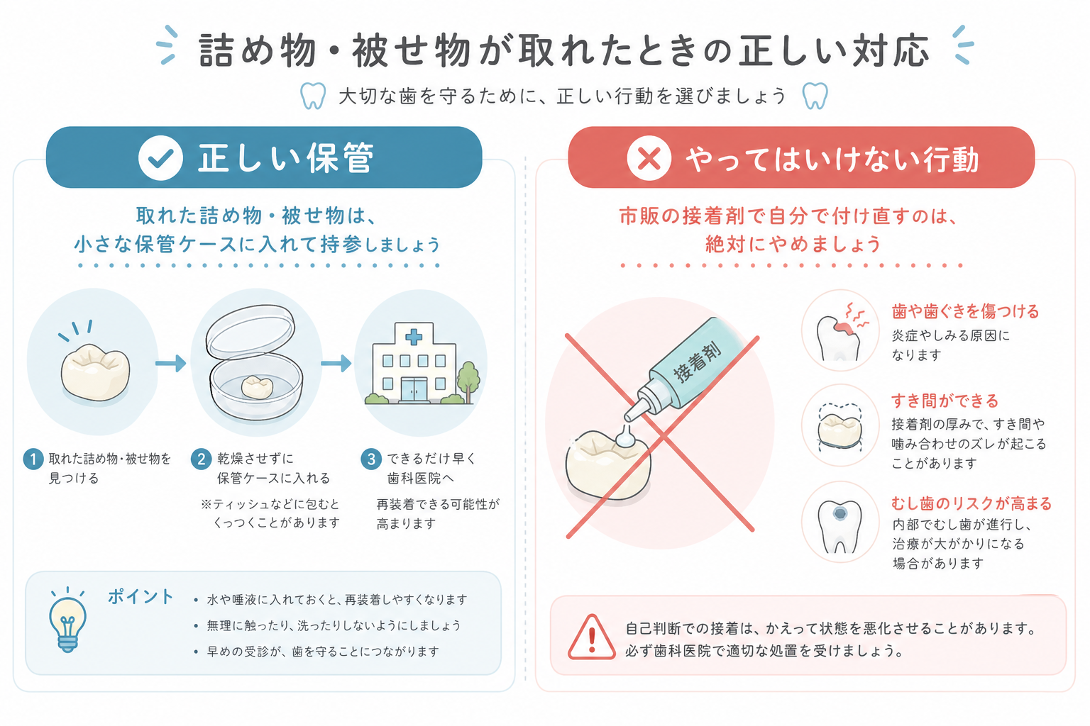 取れた詰め物の正しい保管と、市販接着剤での自己修復がNGであることを対比した図