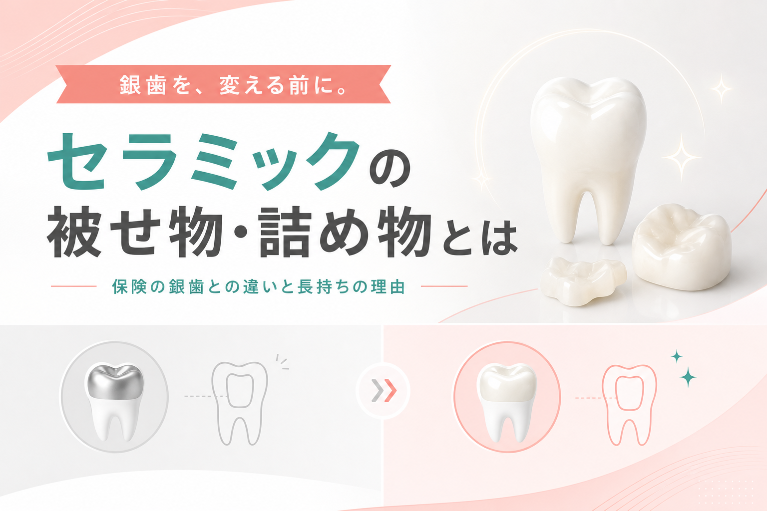セラミックの被せ物・詰め物と保険の銀歯の違いをイメージしたイラスト